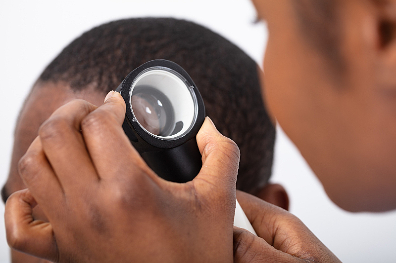 WHAT ARE THE MAIN DISEASES OF THE SCALP AND HOW ARE THEY TREATED?