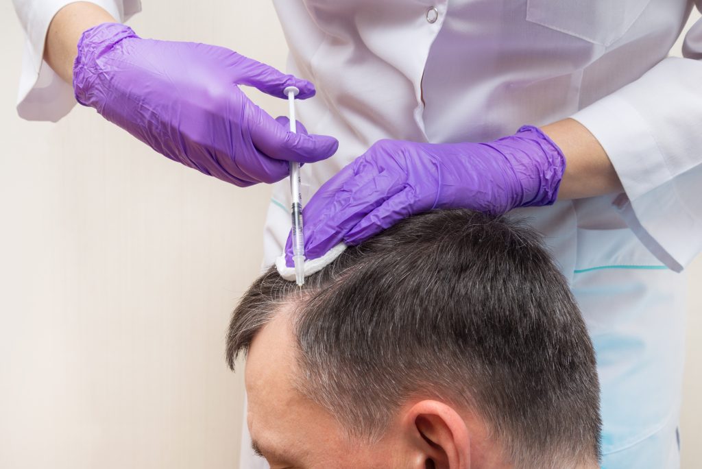 THINGS TO BE DONE BEFORE, DURING AND AFTER HAIR TRANSPLANTATION