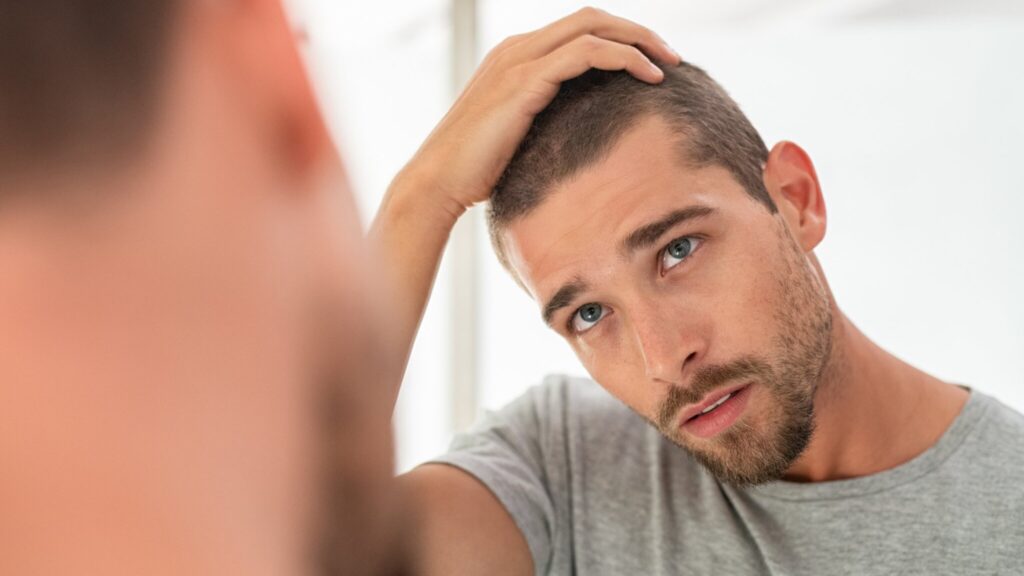Frequently asked questions about hair loss caused by stress